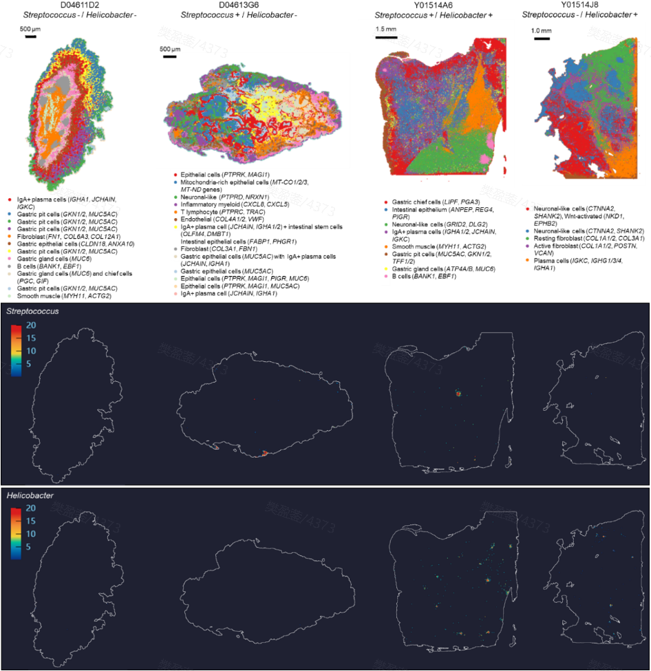 Figure 4. Spatial mapping of bacterial reads in gastric cancer tissue. 